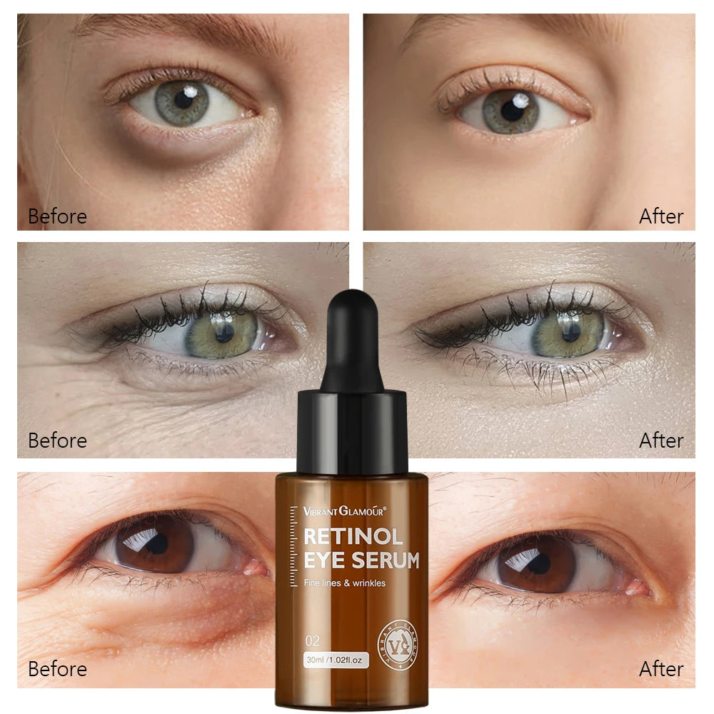 Retinol Face Whitening Cream